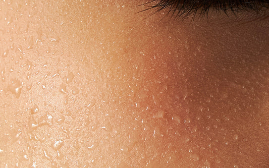 How to Care for Sensitive Skin Without Overdoing It