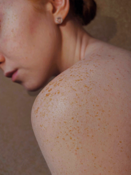 how to tell if your skin barrier is damaged -- and what to do about it